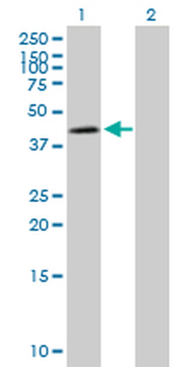 NDUFS2 Antibody in Western Blot (WB)