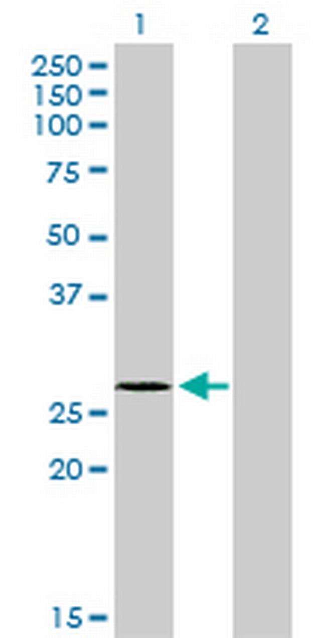 NDUFS3 Antibody in Western Blot (WB)