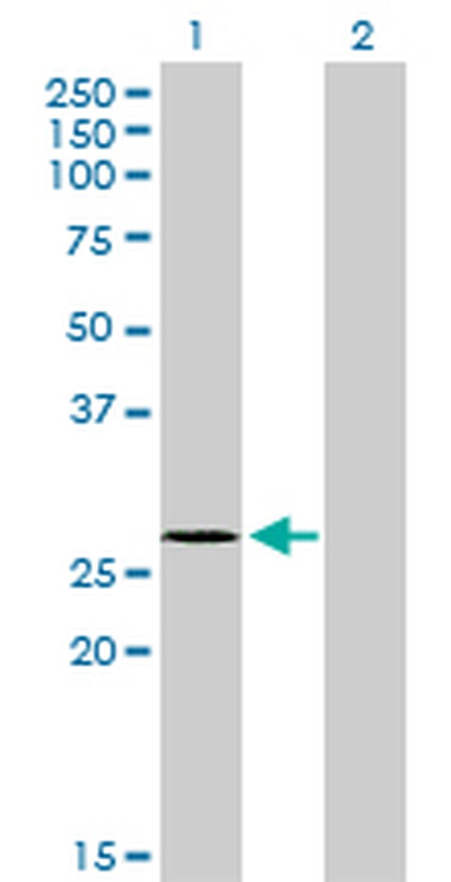 NDUFS3 Antibody in Western Blot (WB)