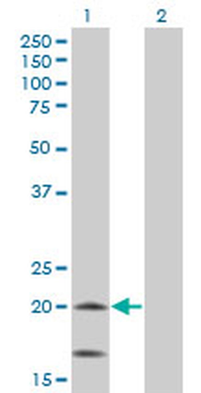 NDUFS4 Antibody in Western Blot (WB)