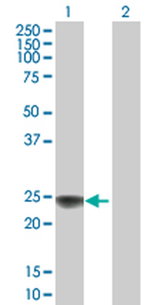 NDUFS8 Antibody in Western Blot (WB)