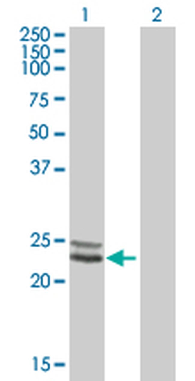 NDUFV2 Antibody in Western Blot (WB)