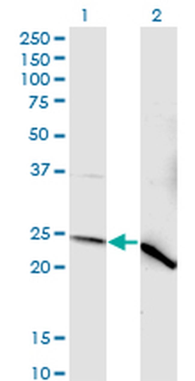 NDUFV2 Antibody in Western Blot (WB)