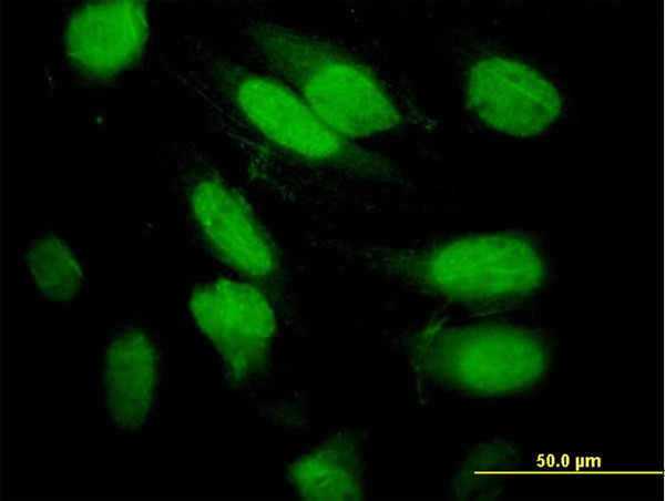 SEPT2 Antibody in Immunocytochemistry (ICC/IF)