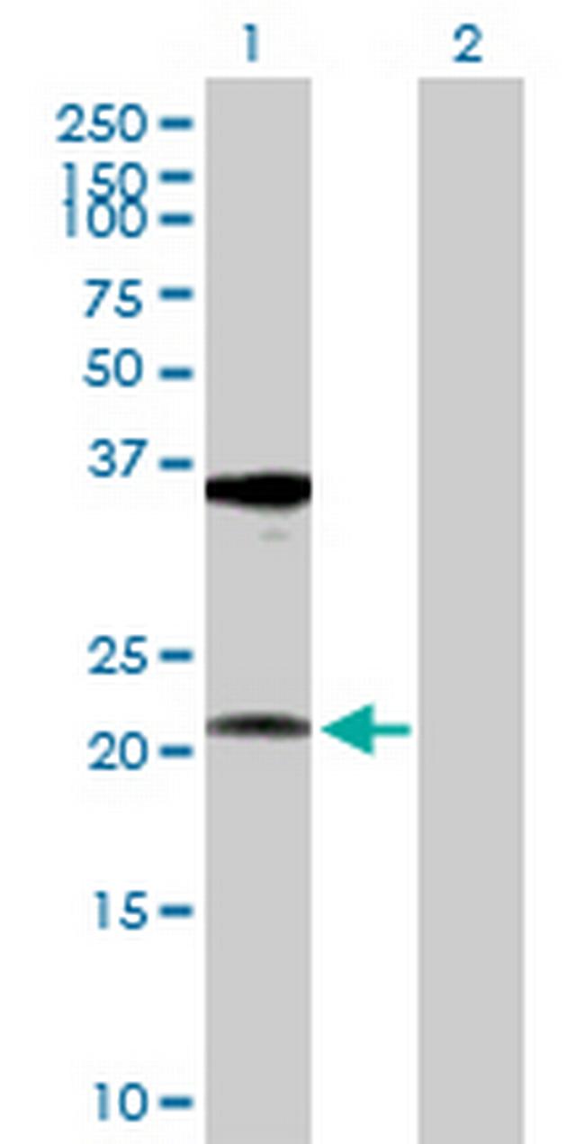 RPL10A Antibody in Western Blot (WB)