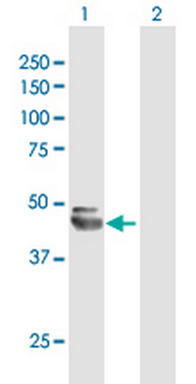 NEU1 Antibody in Western Blot (WB)