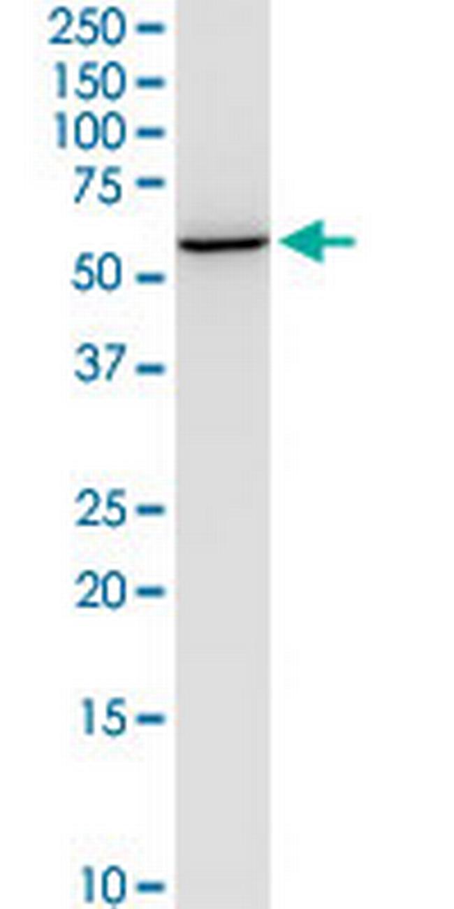 NEU1 Antibody in Western Blot (WB)