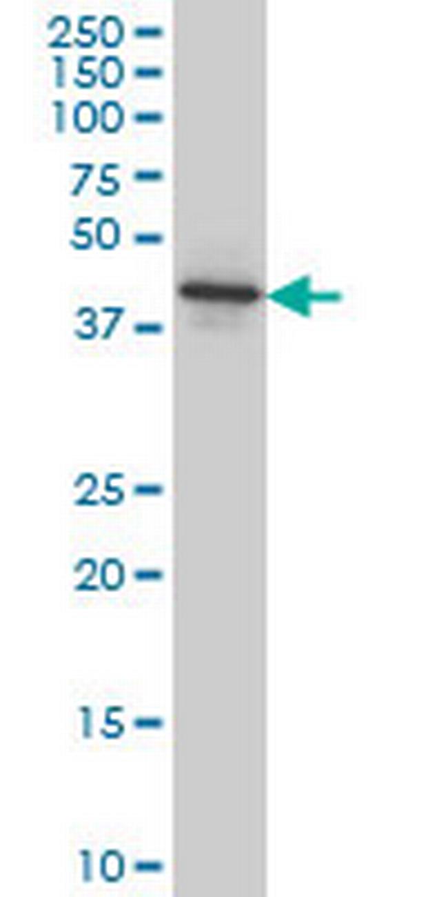 NEU2 Antibody in Western Blot (WB)