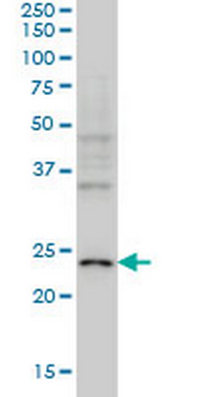 NEUROG1 Antibody in Western Blot (WB)