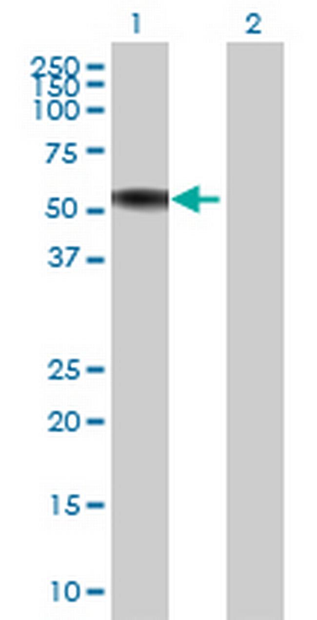 NFIC Antibody in Western Blot (WB)