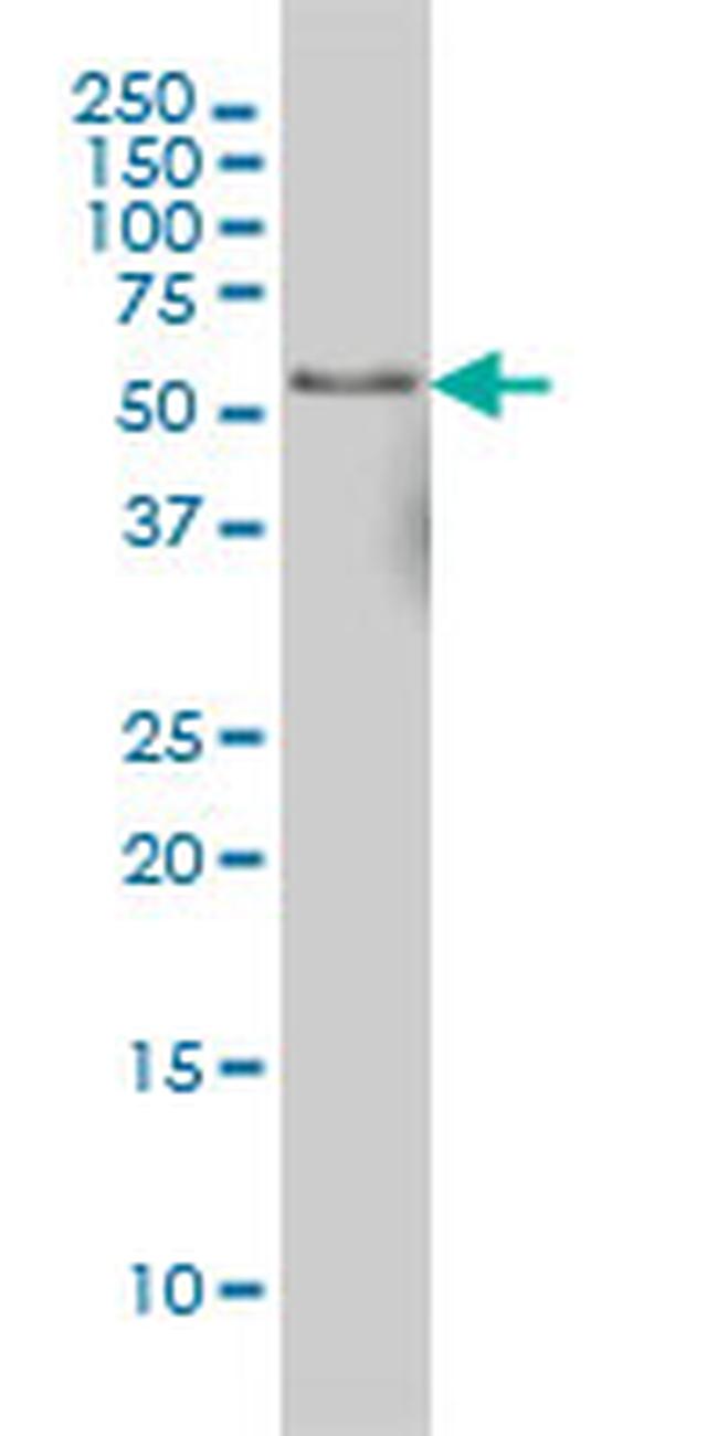 NFIC Antibody in Western Blot (WB)