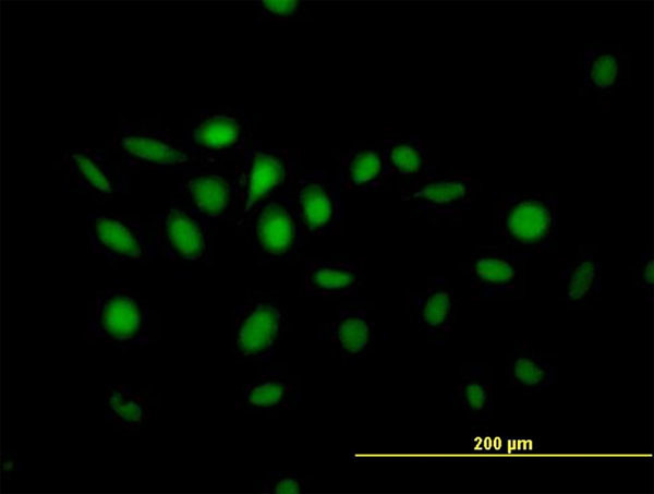 NFIX Antibody in Immunocytochemistry (ICC/IF)