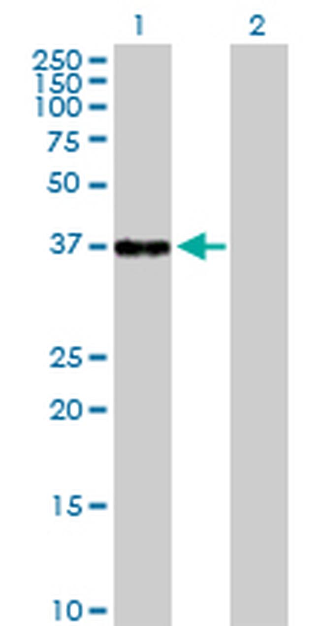 NFKBIB Antibody in Western Blot (WB)