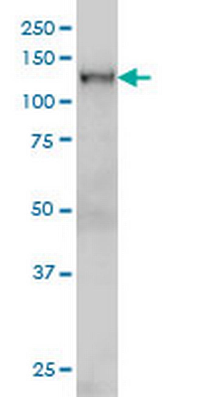 NFX1 Antibody in Western Blot (WB)