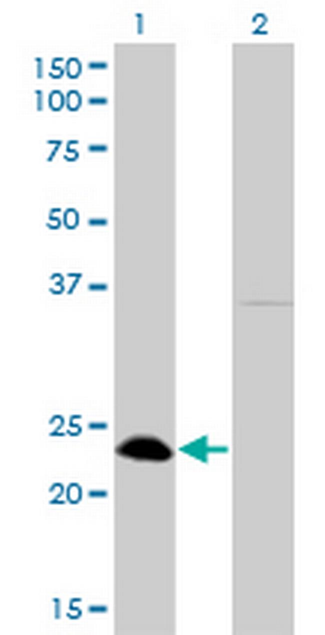 NFYB Antibody in Western Blot (WB)
