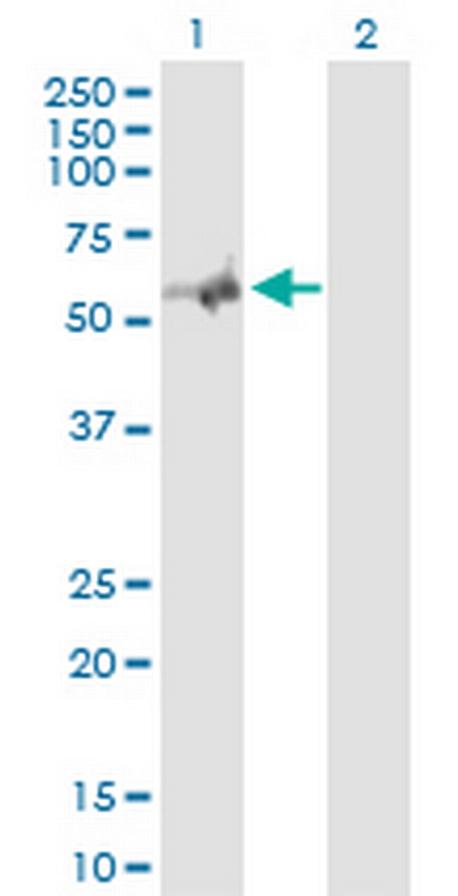 NGFR Antibody in Western Blot (WB)