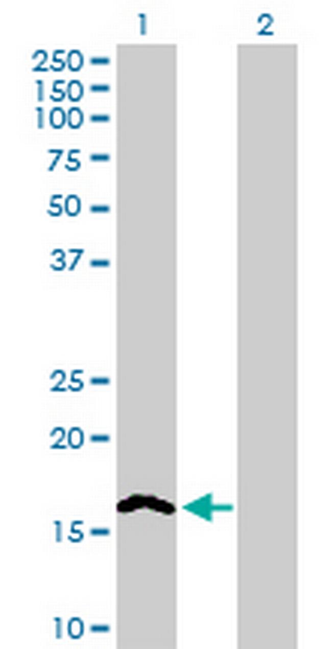 NINJ2 Antibody in Western Blot (WB)