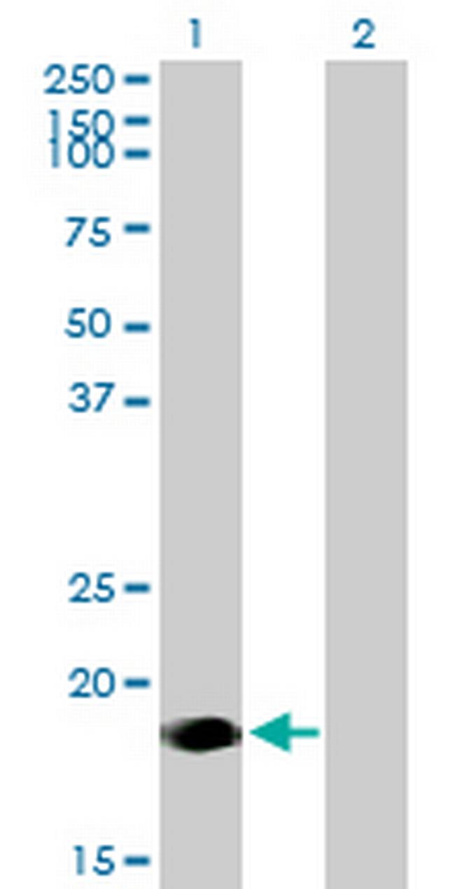 NINJ2 Antibody in Western Blot (WB)
