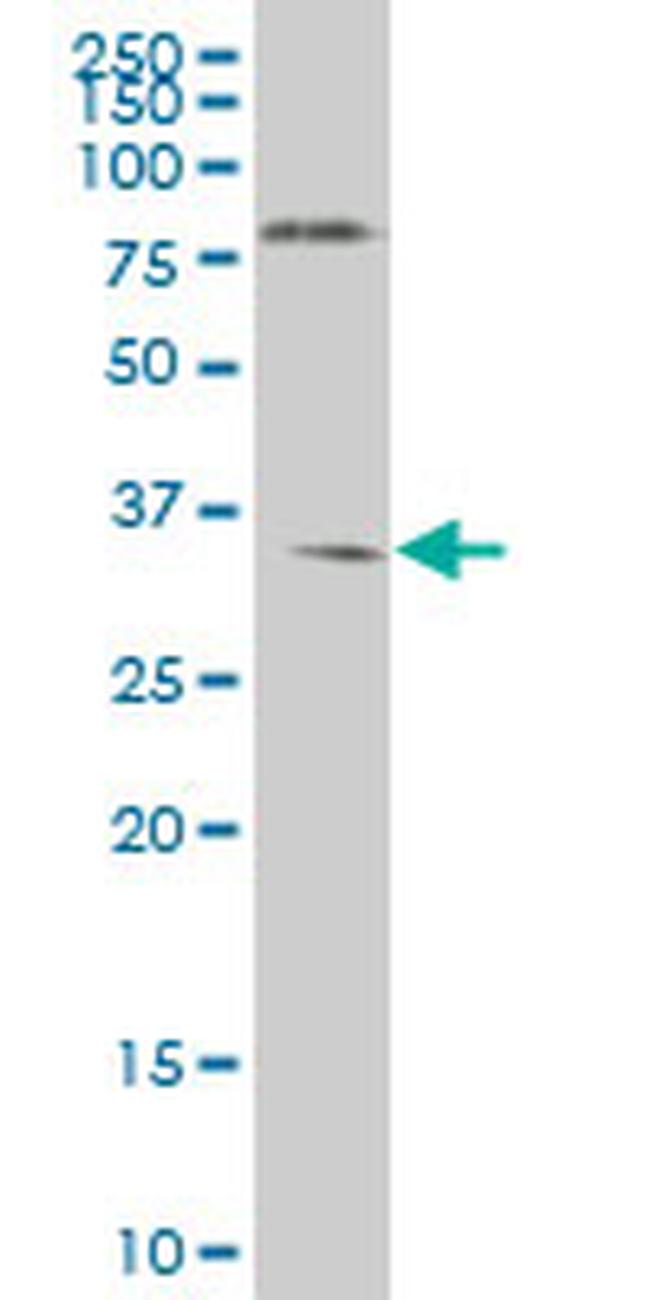 NKX6-1 Antibody in Western Blot (WB)