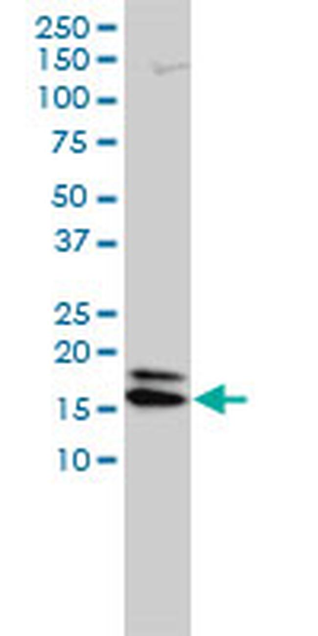 NME2 Antibody in Western Blot (WB)