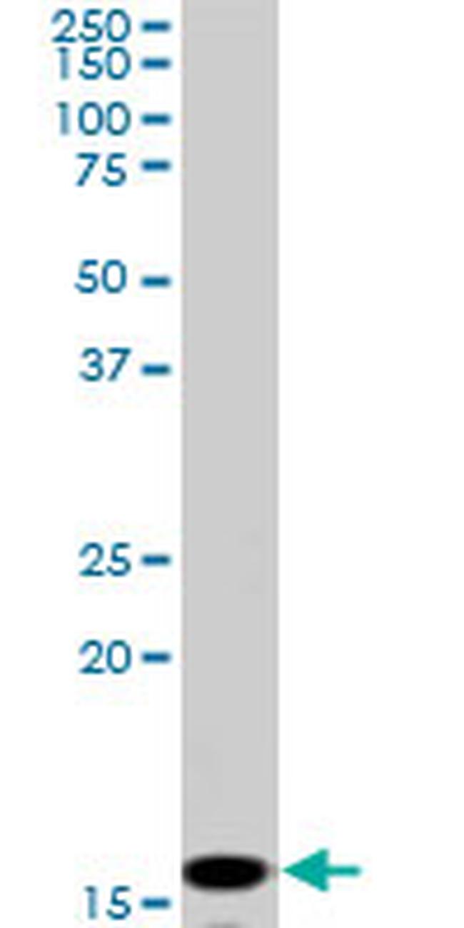NME2 Antibody in Western Blot (WB)