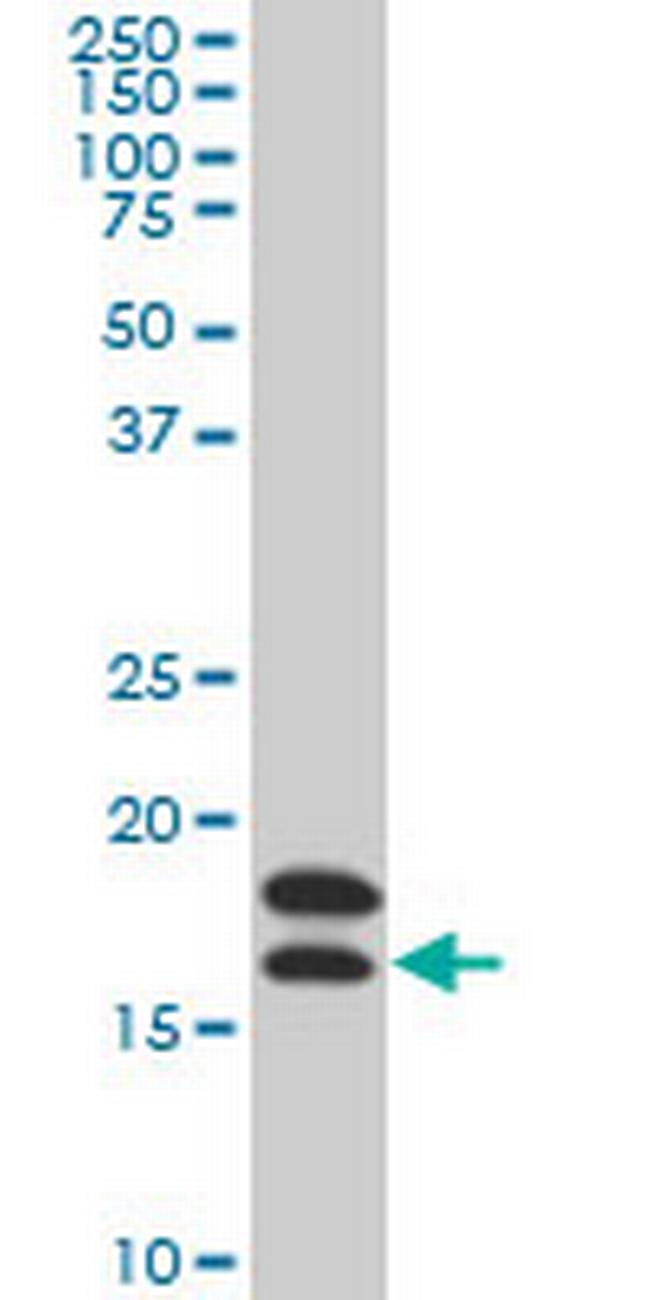 NME2 Antibody in Western Blot (WB)