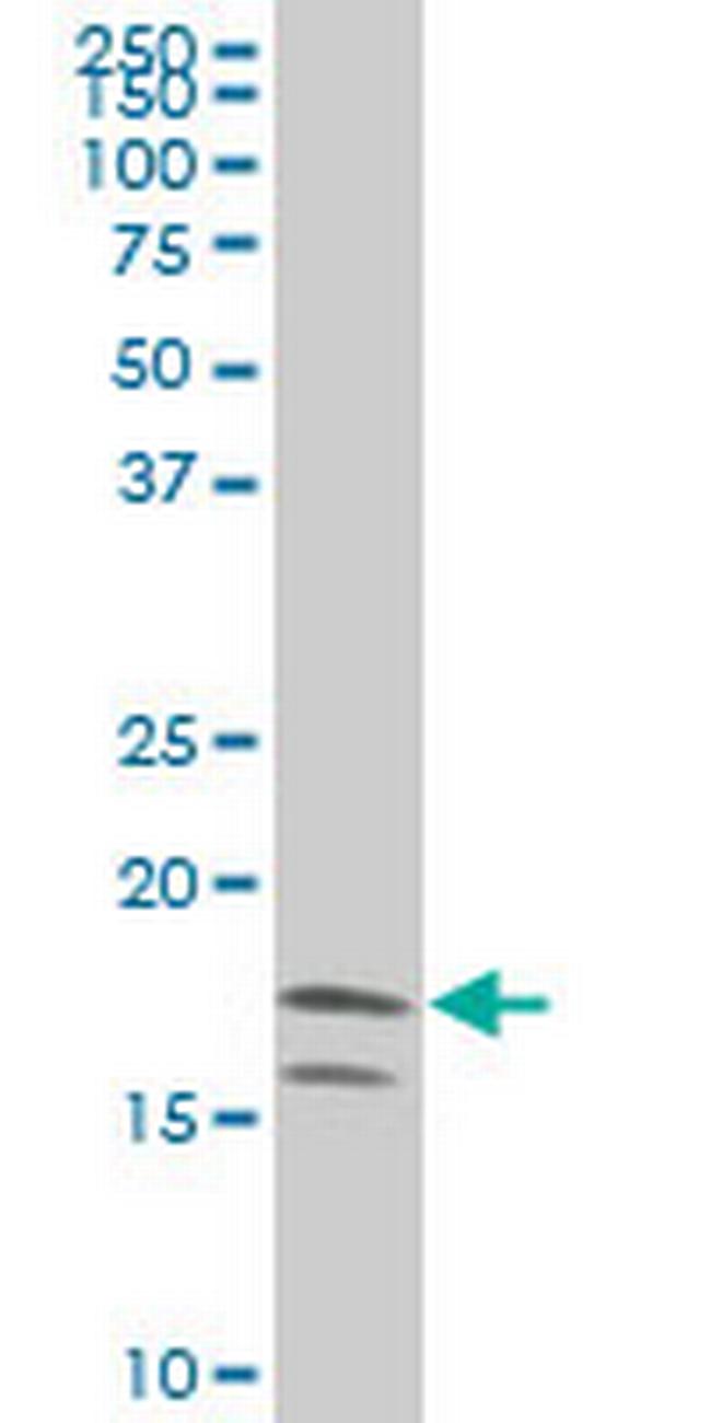 NME2 Antibody in Western Blot (WB)