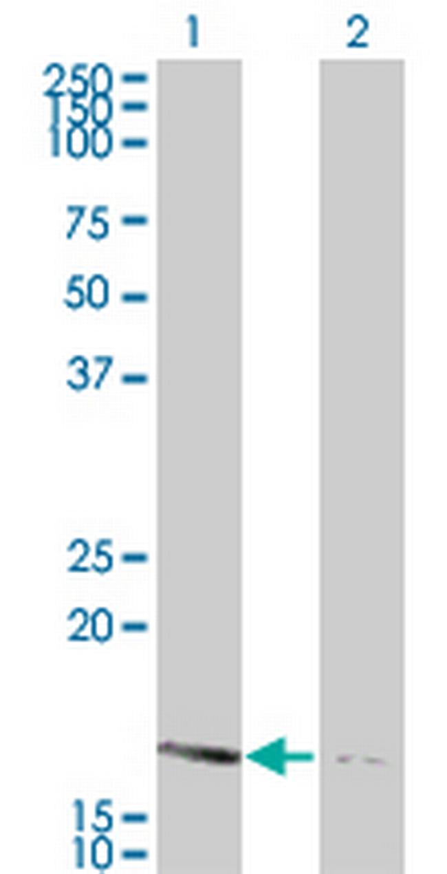 NME2 Antibody in Western Blot (WB)