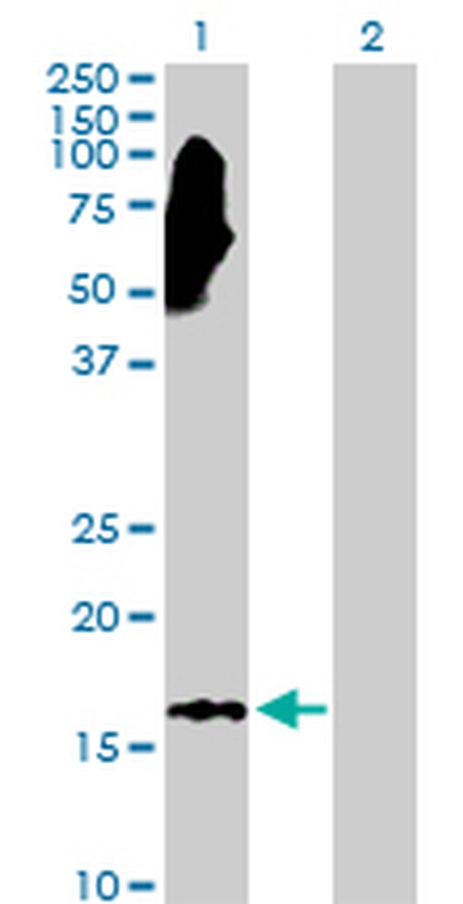 NME3 Antibody in Western Blot (WB)