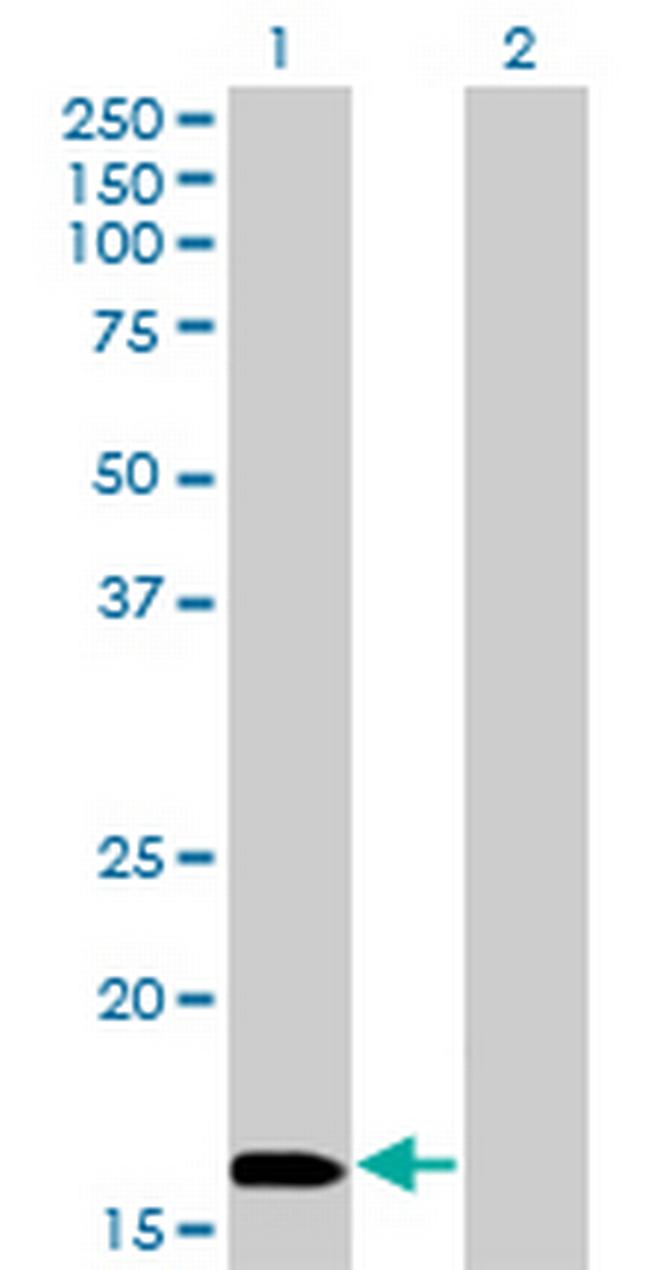 NME3 Antibody in Western Blot (WB)