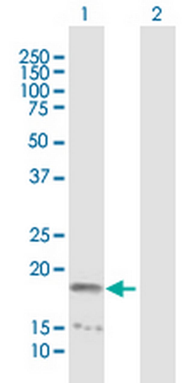 NME4 Antibody in Western Blot (WB)