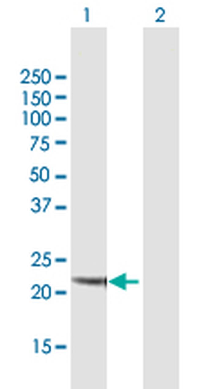 NQO2 Antibody in Western Blot (WB)
