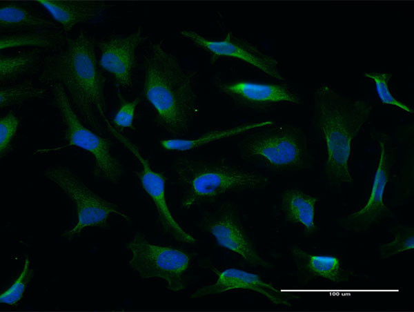 NQO2 Antibody in Immunocytochemistry (ICC/IF)
