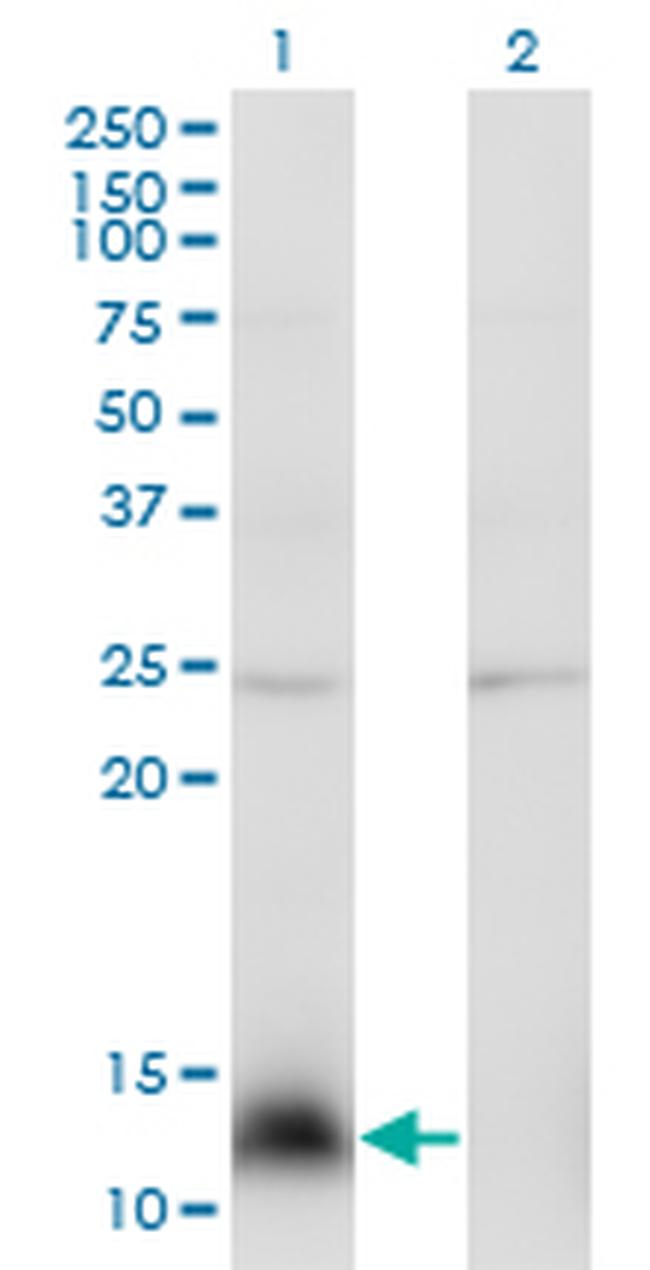 NPY Antibody in Western Blot (WB)