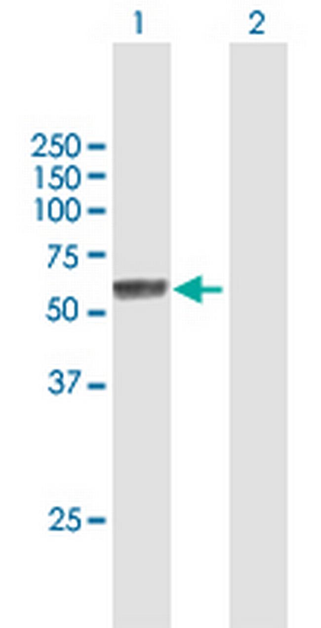 NOVA1 Antibody in Western Blot (WB)