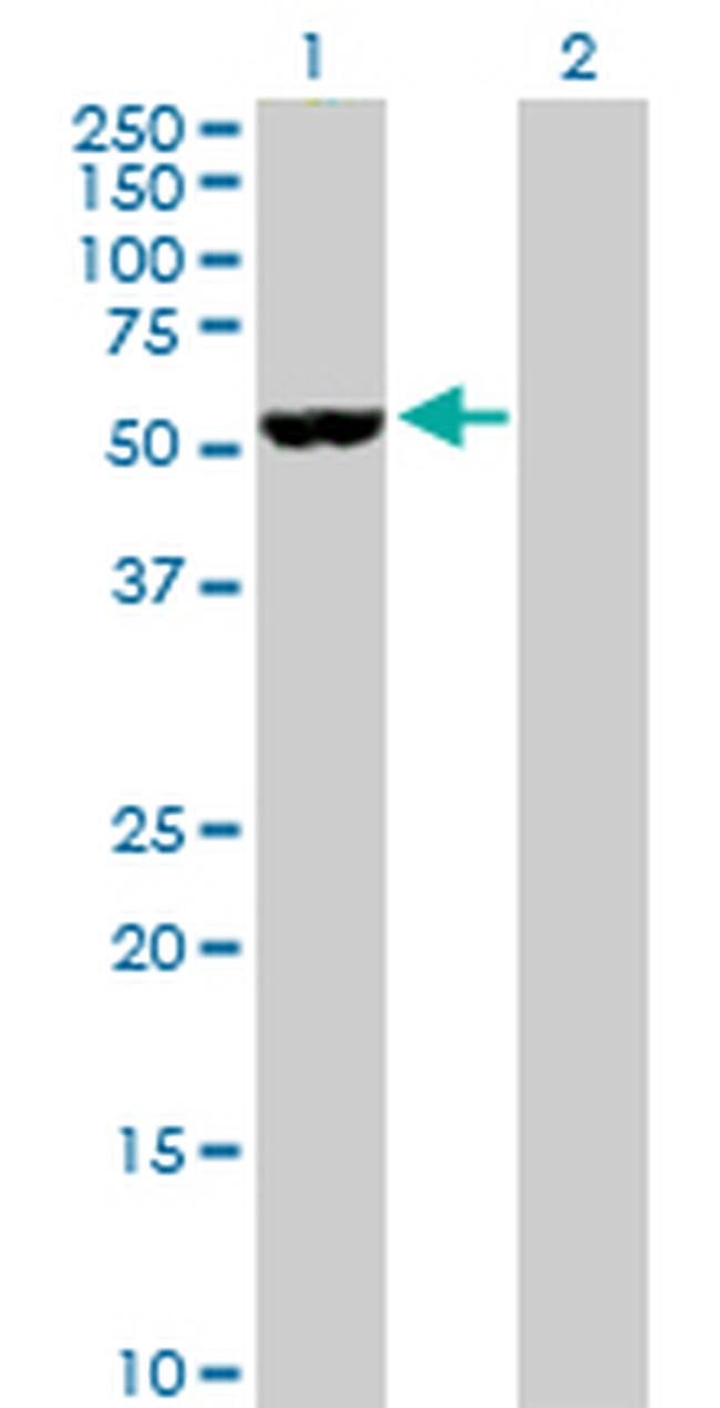 NOVA1 Antibody in Western Blot (WB)