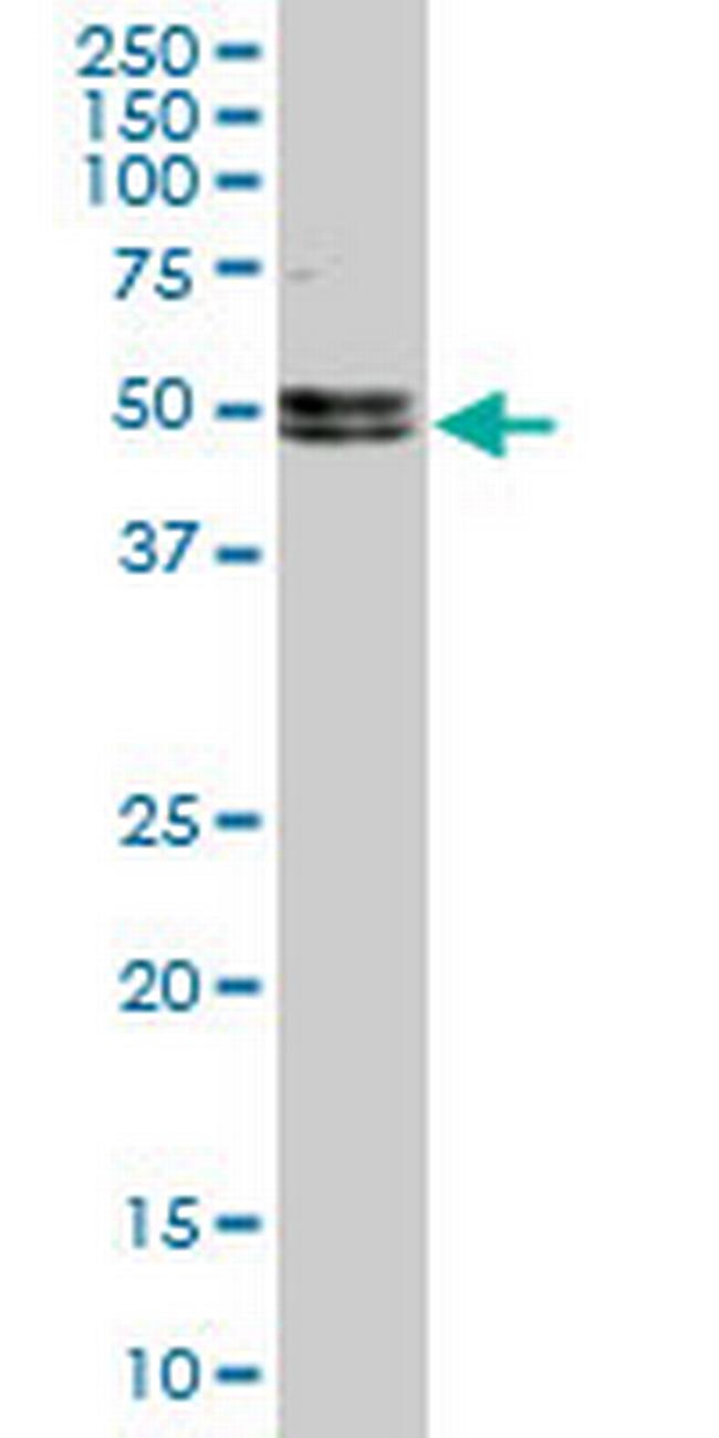 NOVA1 Antibody in Western Blot (WB)