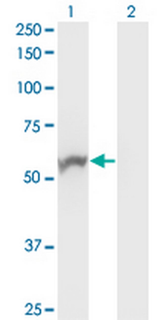NOVA1 Antibody in Western Blot (WB)