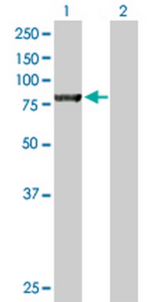NSF Antibody in Western Blot (WB)