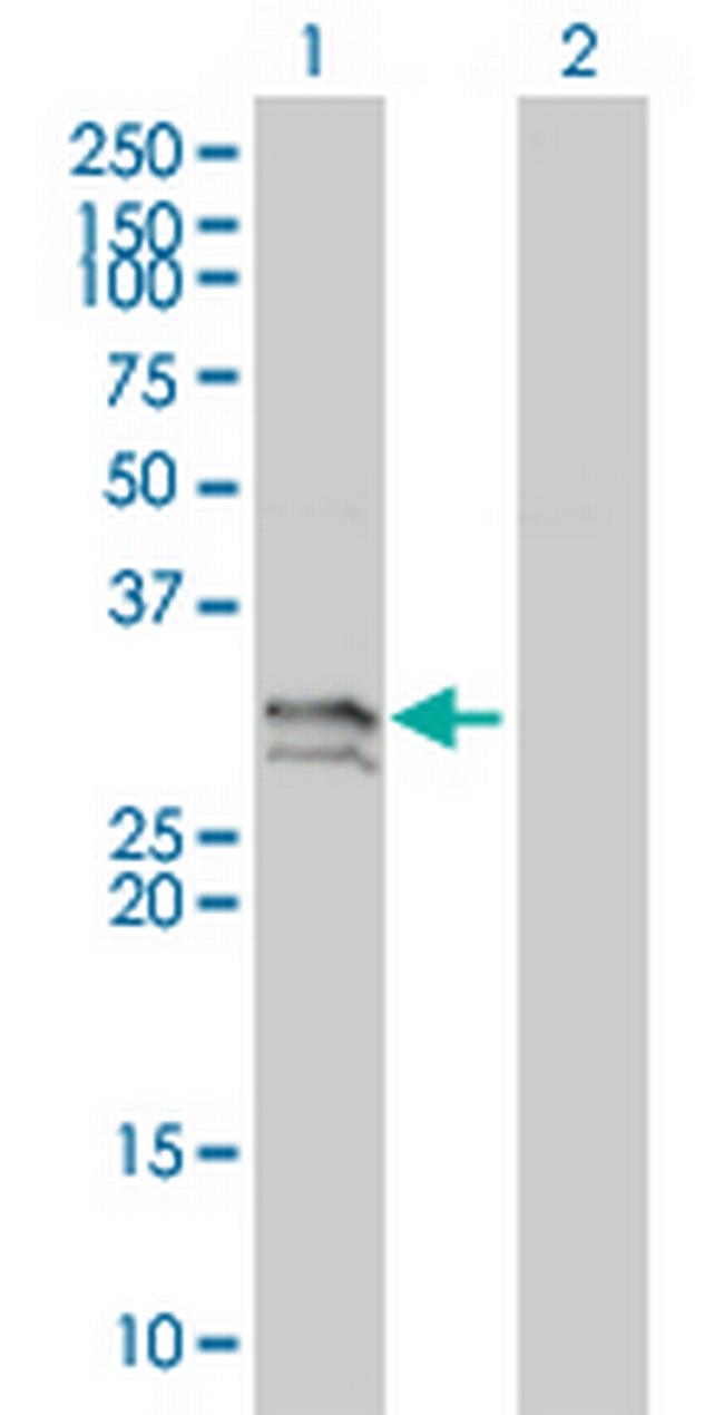 NT5E Antibody in Western Blot (WB)