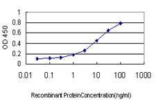 NTRK2 Antibody in ELISA (ELISA)