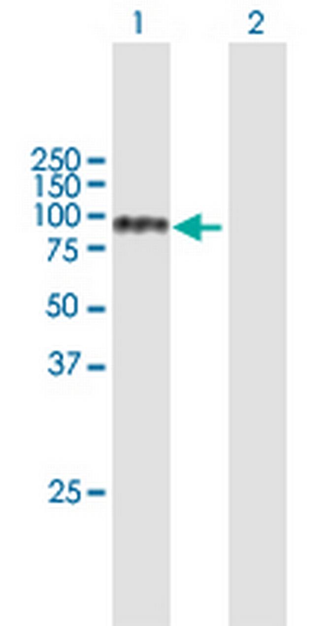 NTRK3 Antibody in Western Blot (WB)