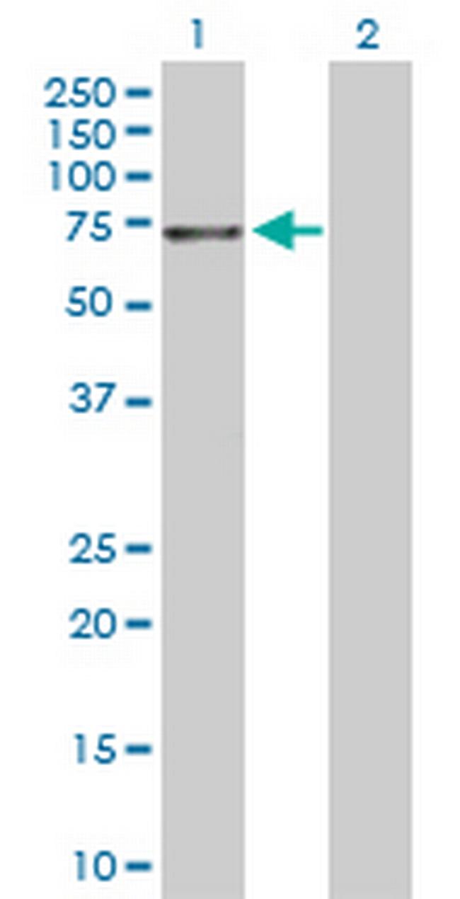 NTRK3 Antibody in Western Blot (WB)