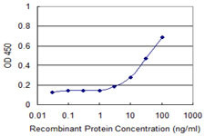 ROR2 Antibody in ELISA (ELISA)
