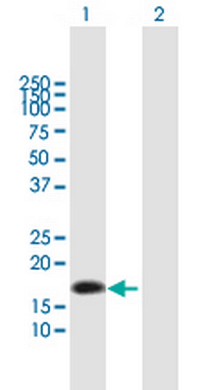 NTS Antibody in Western Blot (WB)