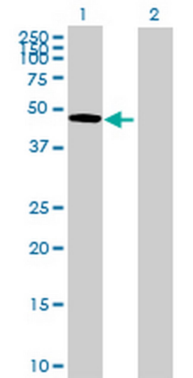 OMD Antibody in Western Blot (WB)