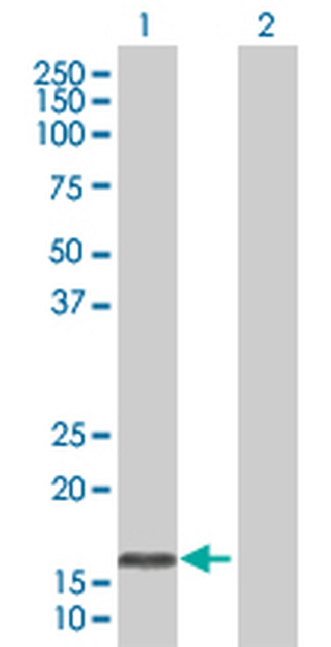 OMP Antibody in Western Blot (WB)