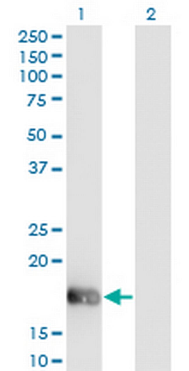 OMP Antibody in Western Blot (WB)