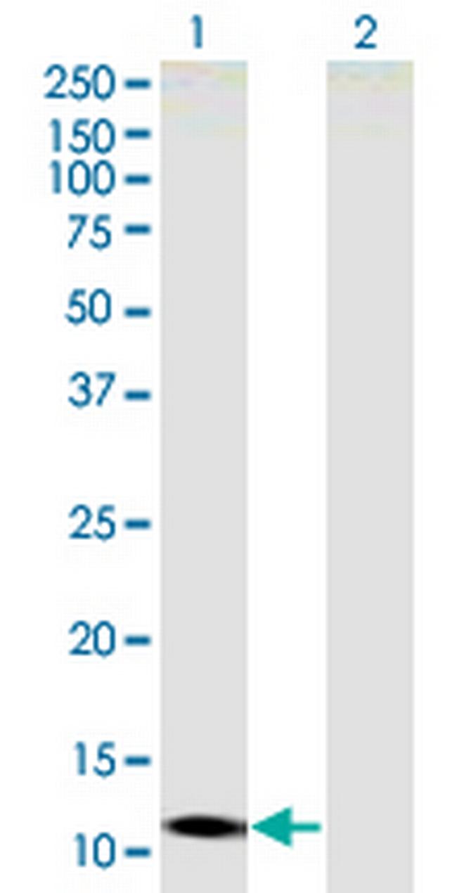 SLC22A18AS Antibody in Western Blot (WB)