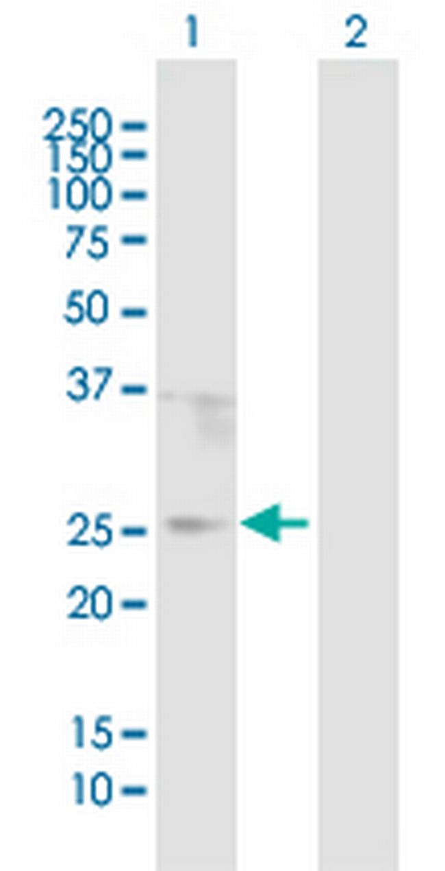ORM1 Antibody in Western Blot (WB)